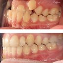 ارتودنسی دندان و درمان فک