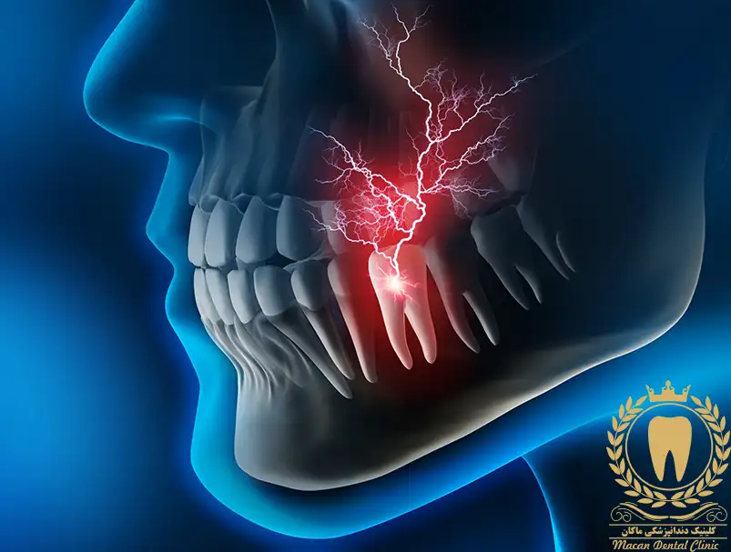 درمان سریع دندان درد در شب