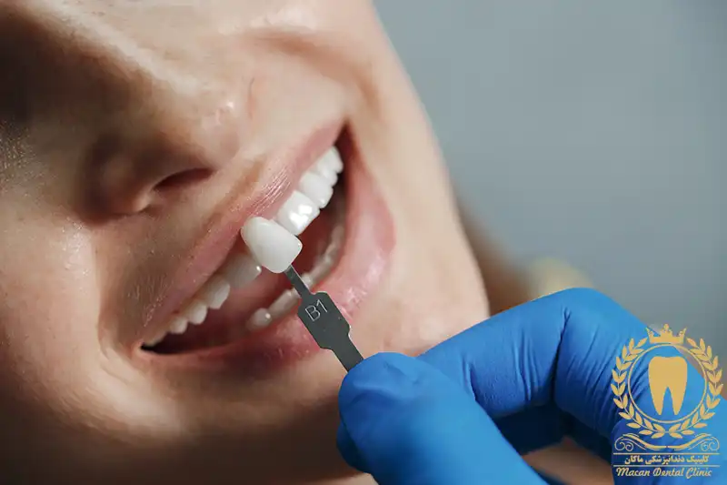 دندانپزشک زیبایی و ترمیمی