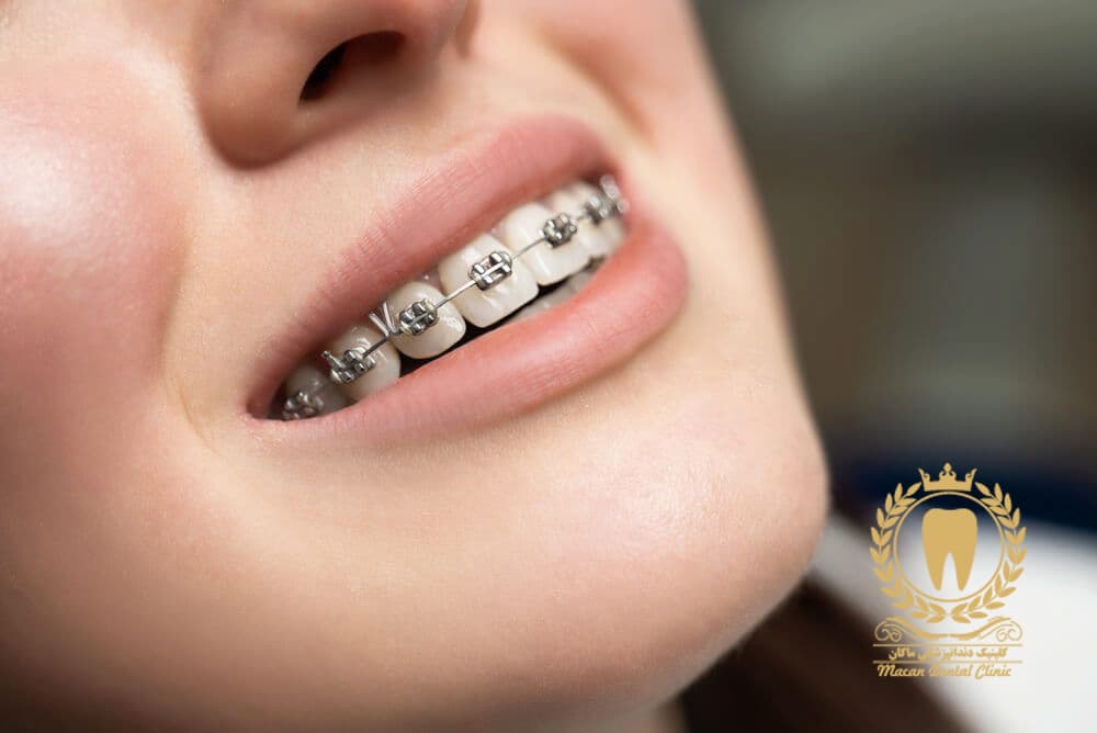 کلینیک ارتودنسی دندان در تهران